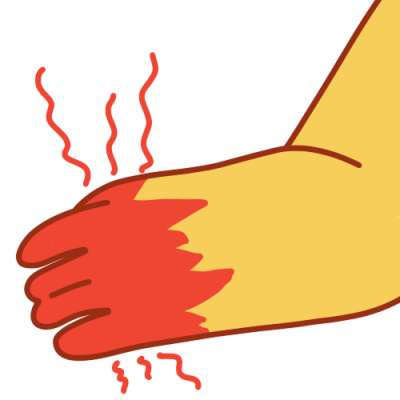 An arm with a red mark on the entire hand and red zigzags radiating from the area